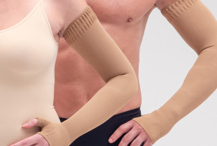 Es linfedema de las extremidades superiores causas y sintomas cta 636bd13ba4b7e